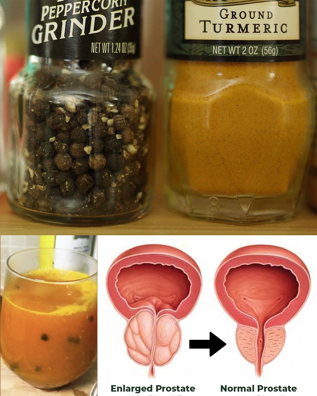 Turmeric: Nature’s Golden Shield for Prostate Health and Beyond