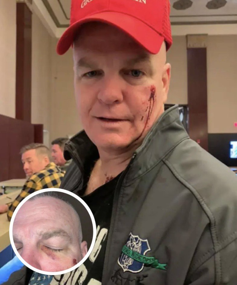 Woman Punches Retired NYPD Detective Because Of His ‘Birthday Hat’