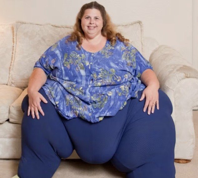 People Stunned After ‘World’s Heaviest Woman’ Loses 500+ lbs – Here’s What She Looks Like Now