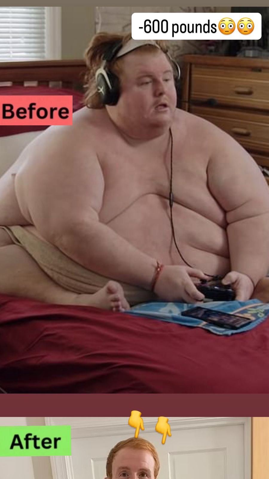 Casey King’s Weight Loss of over 600 lbs: How Bariatric Surgery Helped Him Transform