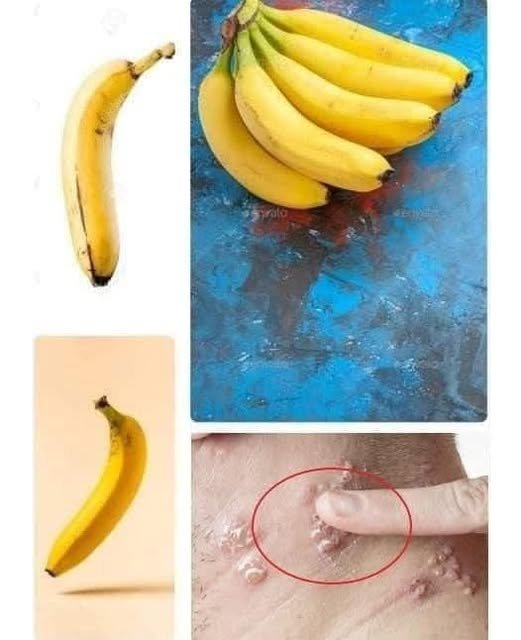 Eat Bananas Every Day? Here’s What Happens to Your Body