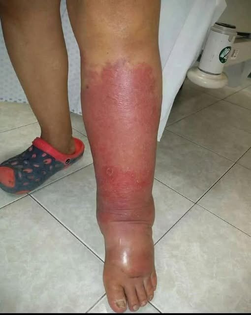 Signs on your FEET that indicate he is cr… see more