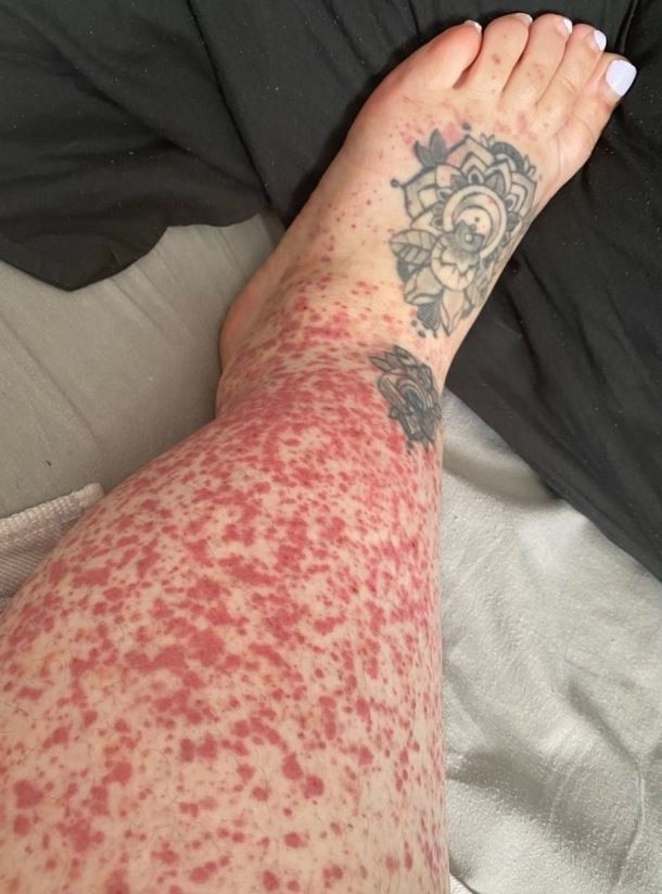 These are the consequences of sleeping with…