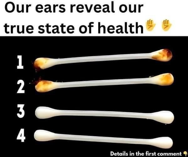 What Do Your Ears Reveal About Your Health?
