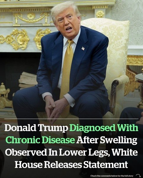 Donald Trump diagnosed