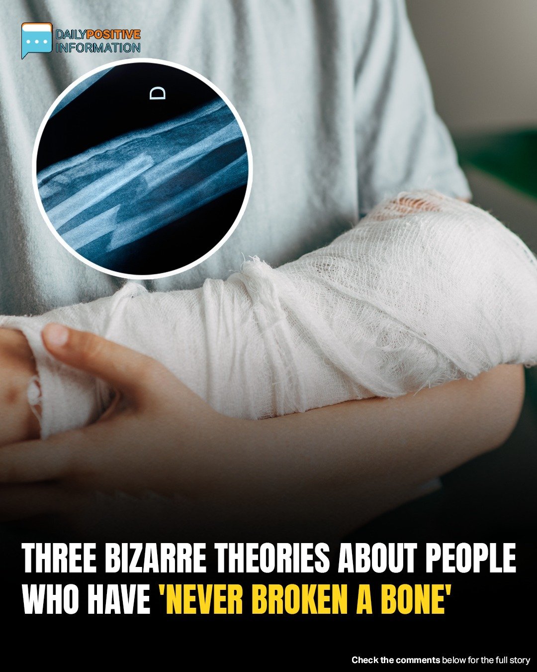 Why Some People Never Break A Bone—3 Wild Theories Explained