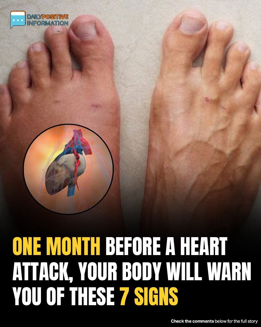 One Month Before A Heart Attack, Your Body Will Warn You Of These 7 Signs