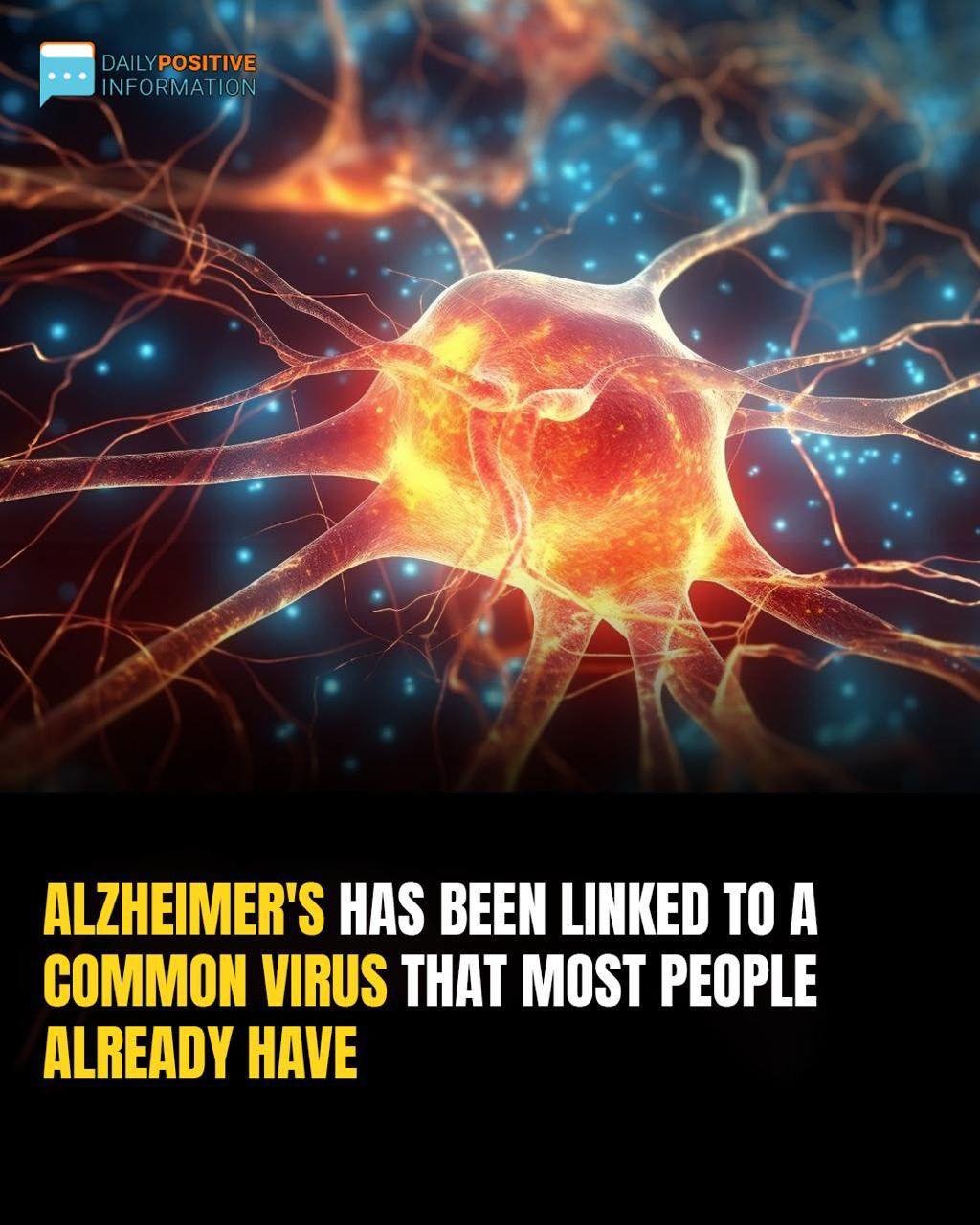 Scientists Say Viral Infections Could Be The Hidden Cause Of Alzheimer’s — 30 Years Of Research Now Validated