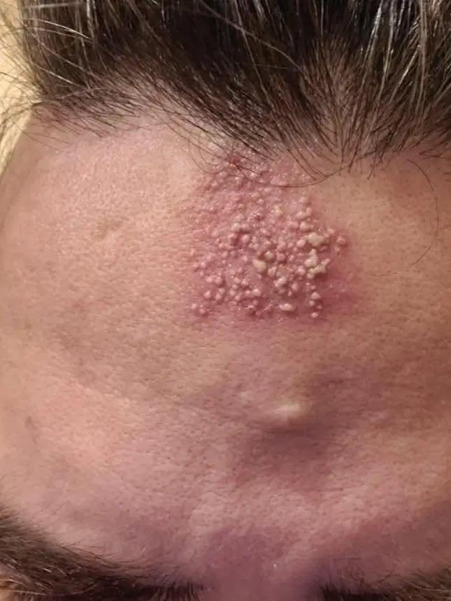 The Real Consequences of Sleeping With…