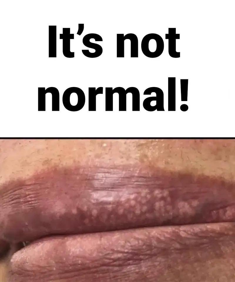 You should be worried if your lips show these signs