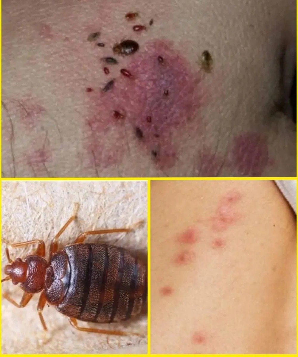 BE CAREFUL, If you spot these dots on your skin, it means…