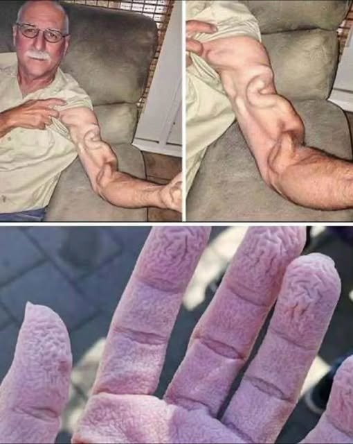 A man goes to stretch and ends up feeling a sharp pain in his arm, it was a ca…