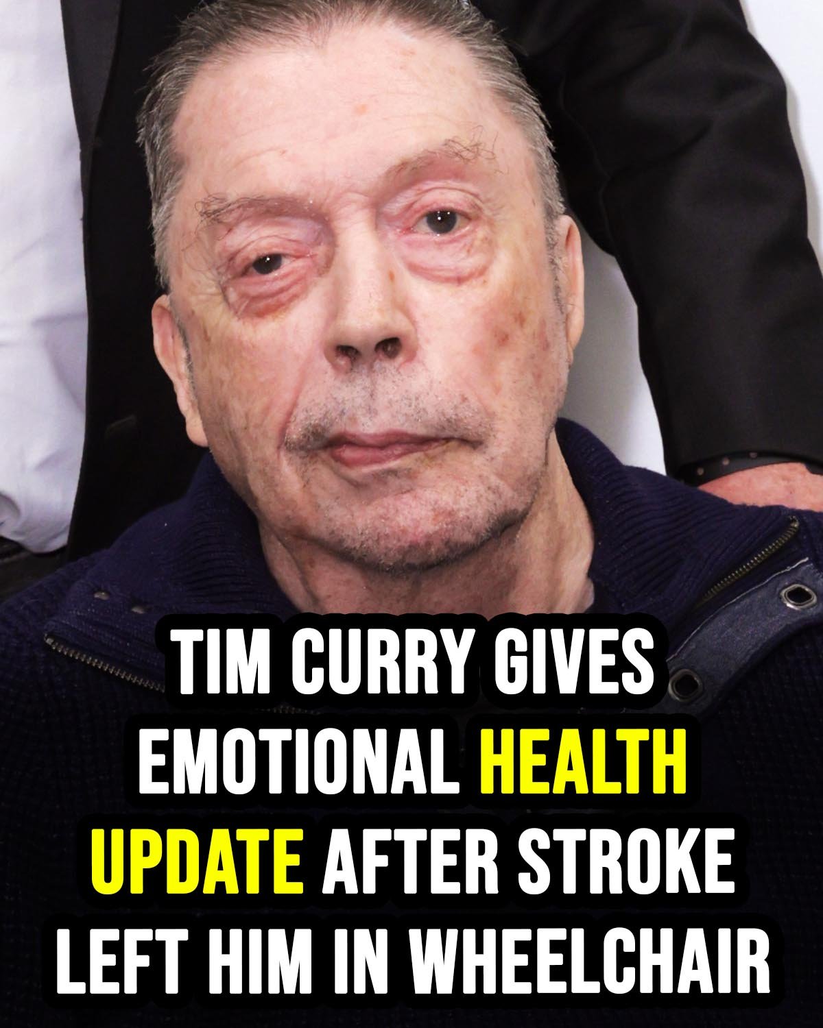 Tim Curry says his skull was ‘smashed in’ during emergency surgery after 2012 stroke