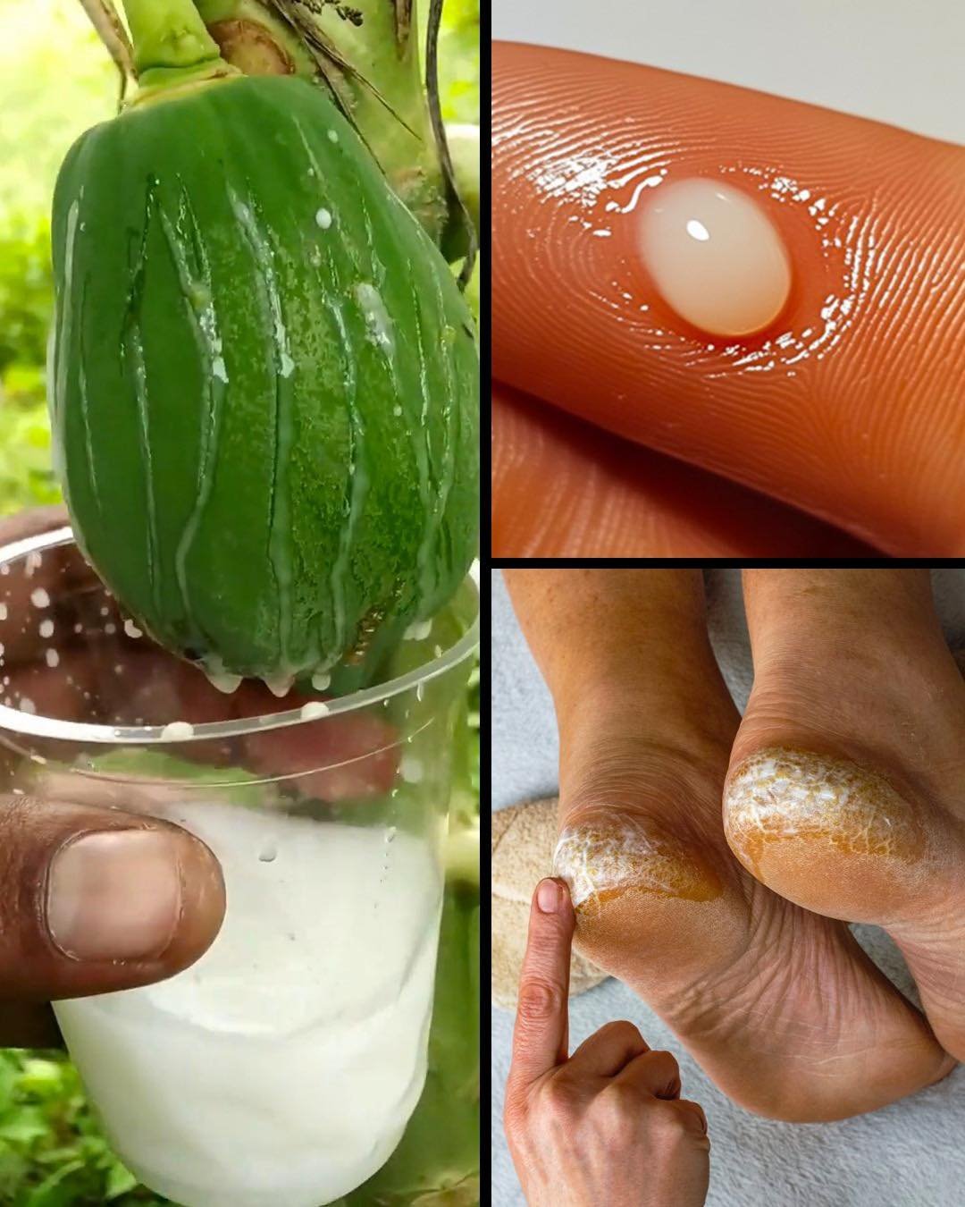Papaya Sap for Cracked Heels: A Simple Natural Remedy