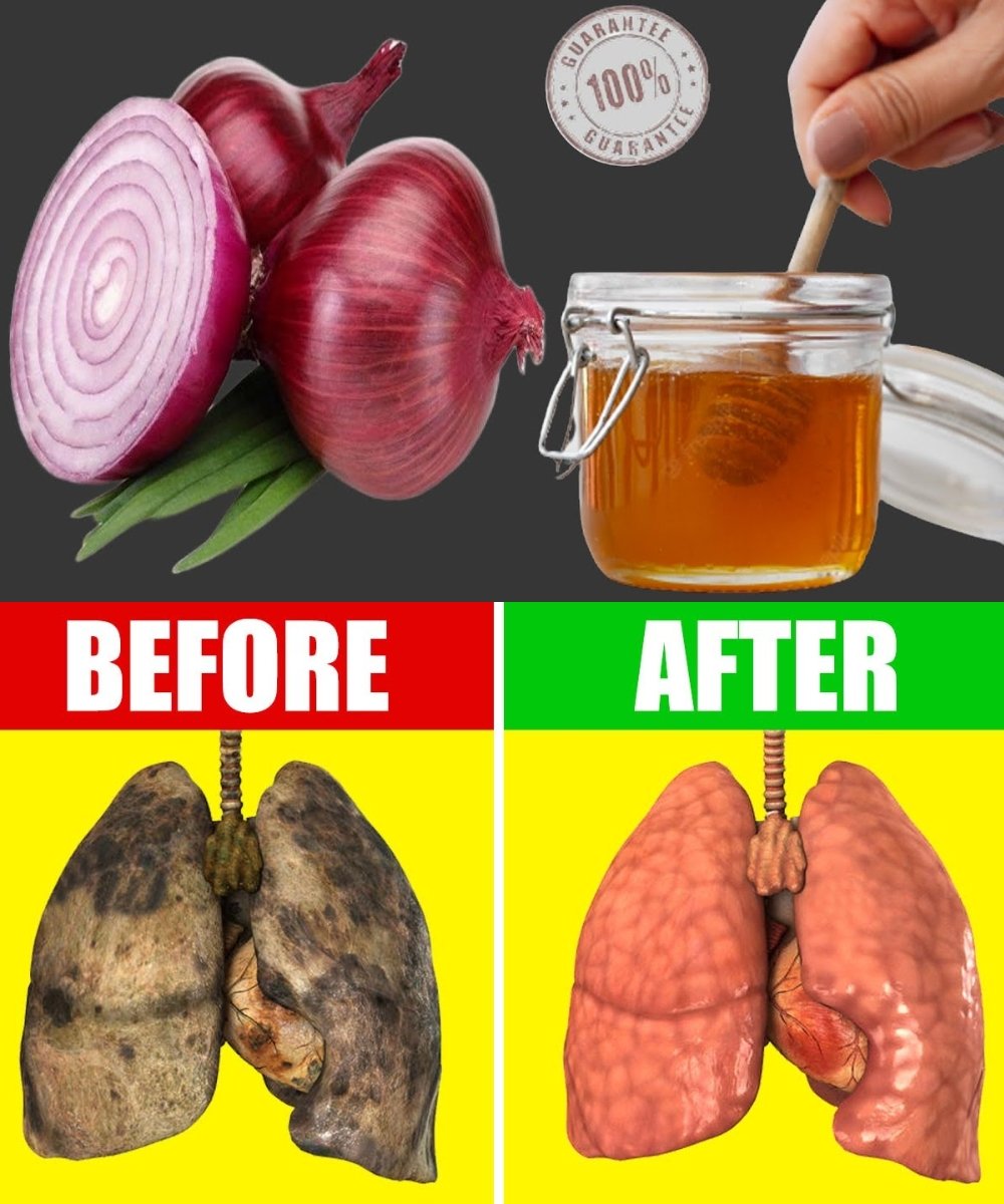 Clear Your Lungs and Relieve Cough in 1 Day: The Onion and Honey Remedy That Works Like Magic