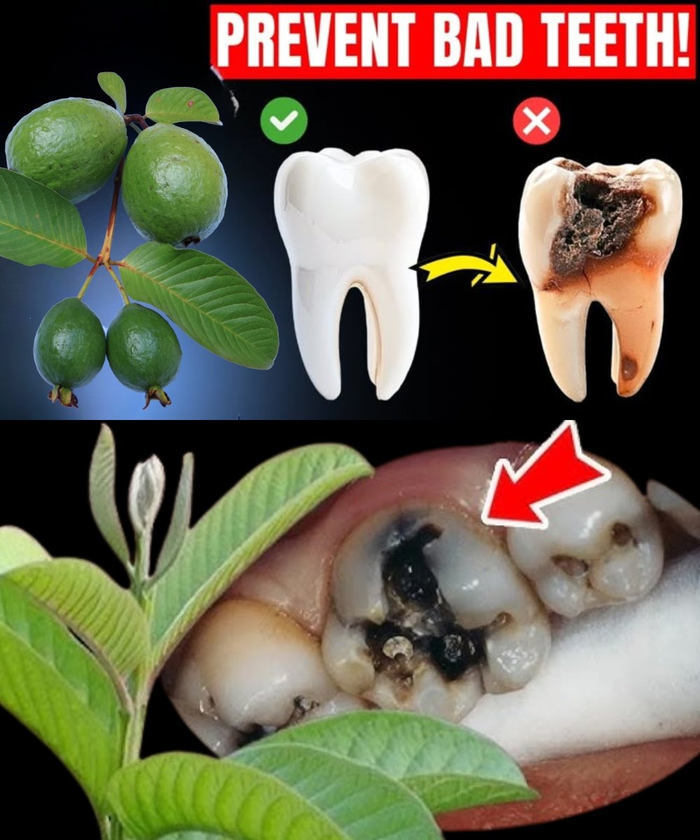 Top 3 Ways to Treat Tooth Decay with Guava Leaves – Simple and Cost-Effective
