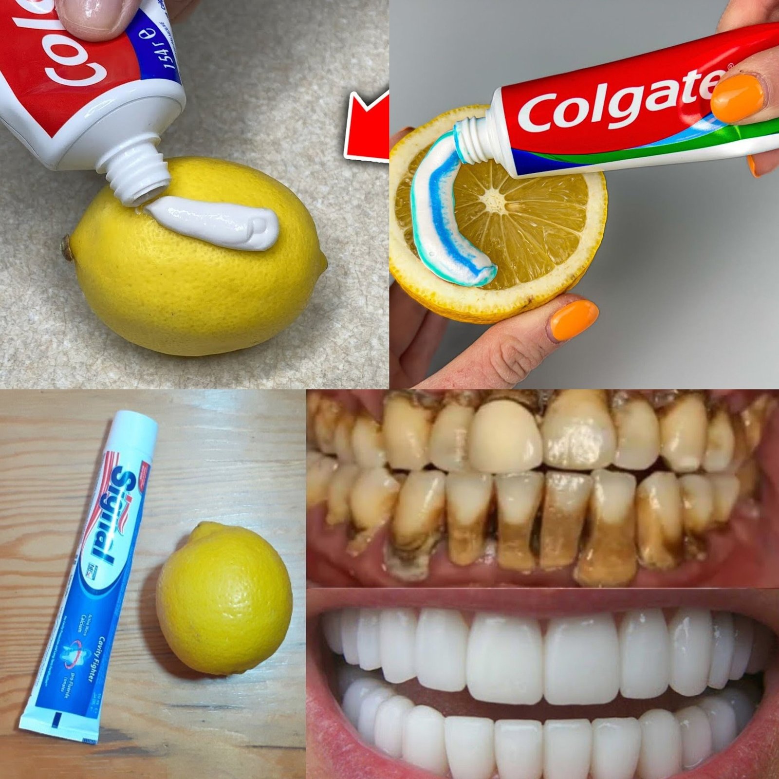 Natural Mixture for Whitening Yellow Teeth at Home in One Day